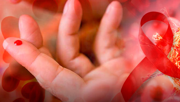 ISP INFORMA LISTADO DE KITS PARA DETECCION DE VIH SIN REGISTRO SANITARIO