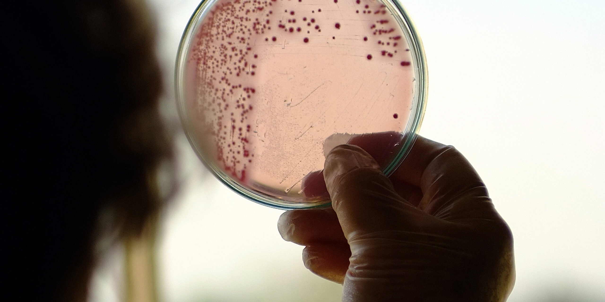 Chile es verificado por la OMS por la eliminación de la lepra: un hito histórico para la salud pública